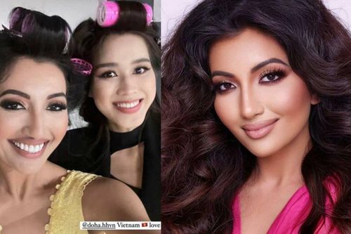 Á hậu Miss World 2021 từng bị bỏng mặt nặng, xem lại ảnh mà thương xót