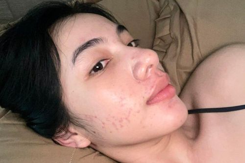 Cẩm Đan - 'tình tin đồn' chồng cũ Lệ Quyên lộ mặt đầy mụn gây sốc