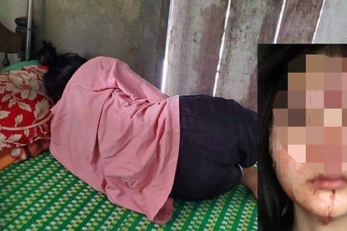 Lộ nguyên nhân nữ sinh lớp 10 ở Huế bị bạn đánh chấn động não