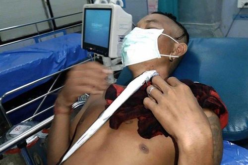 Cá đâm thủng cổ du khách tắm biển