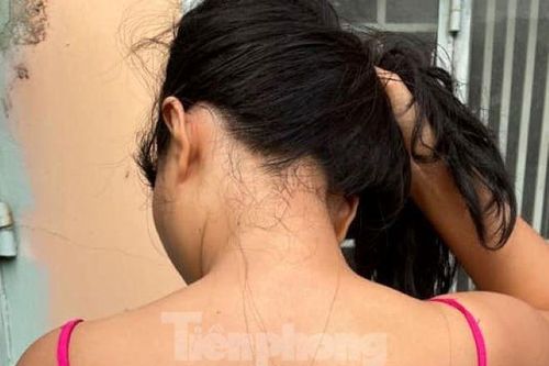 Công an Bình Dương tạm đình chỉ công tác một cán bộ liên quan vụ xô xát vì chuyện đỗ xe