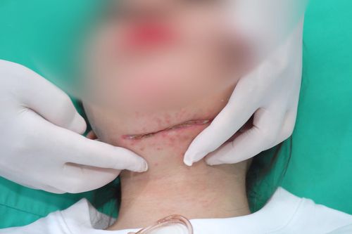 Sở Y tế TPHCM: 'Hành nghề thẩm mỹ chui luôn là vấn đề nóng'