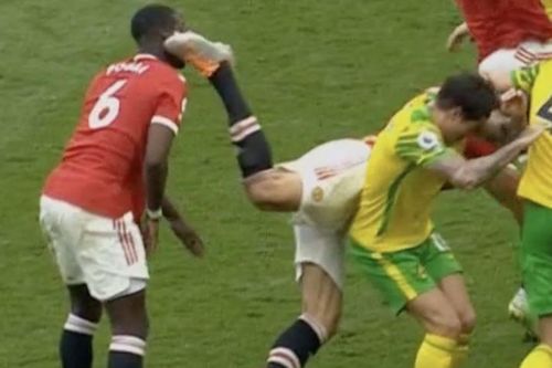 Pogba nổi giận khi bị Maguire làm chảy máu đầu