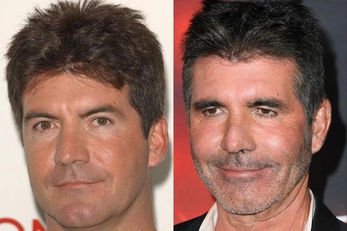 Simon Cowell bị chỉ trích vì tiêm botox và ám ảnh phải đẹp của sao nam