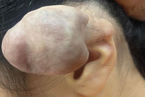 Thể hiện 'chất chơi', cô gái suýt mất tai