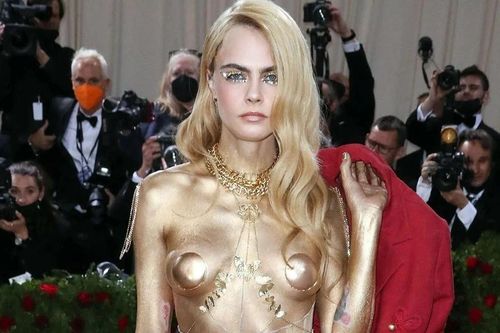 Siêu mẫu Cara Delevingne bị bong tróc da vì bệnh vảy nến