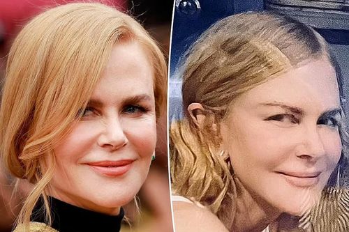 Mặt mộc của 'Thiên nga nước Úc' Nicole Kidman ở tuổi 55 gây tranh cãi