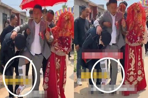 Bị bạn trêu quá đà, chú rể gãy chân trong ngày cưới