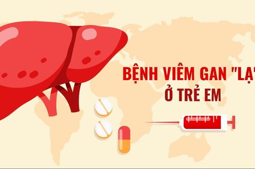 Bệnh viêm gan 'lạ' ở trẻ em