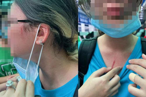 Phụ huynh trường quốc tế tố con bị bạn học đánh, nhà trường chưa xử lý thỏa đáng!