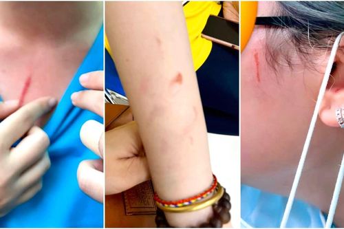 Mạng xã hội xôn xao vụ nhóm nữ sinh trường quốc tế tại TP.HCM ẩu đả