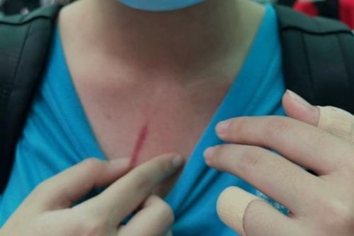 Công an TP.HCM xử lý thông tin vụ nữ sinh ở trường quốc tế bị đánh