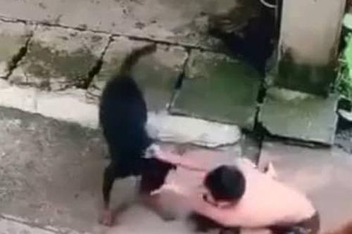 Tình huống pháp lý vụ bé gái 3 tuổi và cha bị hai con chó dữ tấn công