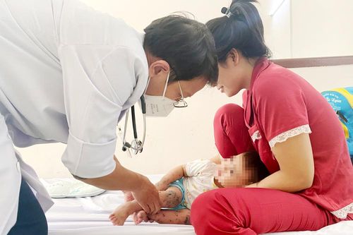 Ngăn bùng phát dịch tay chân miệng
