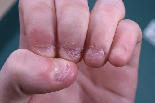 Làm điều cực đơn giản này, bé trai suýt phải cắt cụt chi