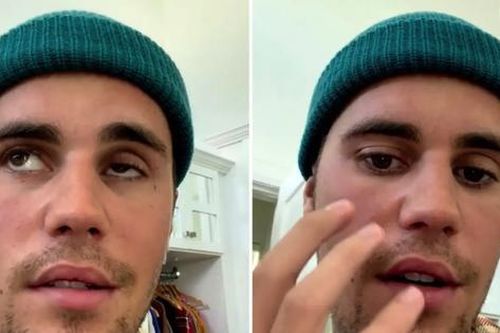 Justin Bieber bị liệt nửa mặt: Fan đứng ngồi không yên, trending hashtag mong idol mau khỏe