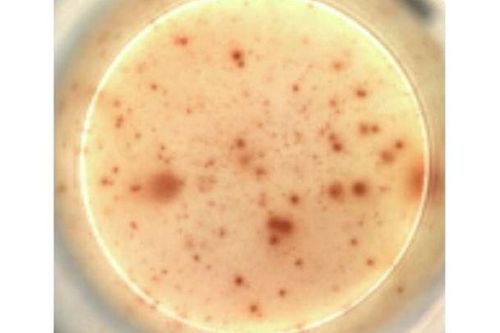 Điều trị HIV bằng vắc-xin