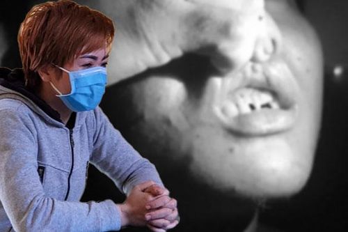 Tra tấn nhân viên như thời trung cổ, nữ chủ quán bánh xèo lĩnh án 30 tháng tù