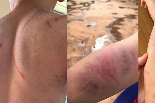 Đắk Lắk: Xác minh, điều tra làm rõ vụ việc cháu bé 9 tuổi bị đánh đập