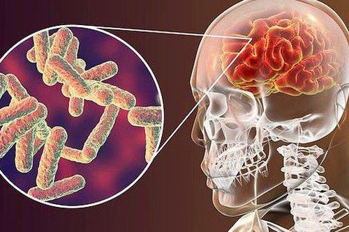 3 trường hợp tử vong do viêm não virus
