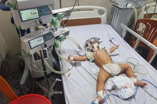 Ngã vào thùng nước của gia đình, bé 8 tháng tuổi suýt tử vong