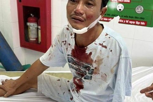 Người tàn tật bị vợ chồng tài xế xe tải đánh nhập viện