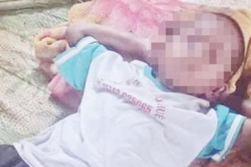 Đưa bé trai bị tẩm xăng đốt đến Bệnh viện Đa khoa vùng Tây Nguyên điều trị
