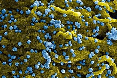 WHO cảnh báo loại virus gây tử vong đến 90%
