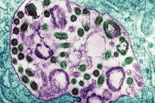 WHO thông báo về 2 ca tử vong do nhiễm loại virus chưa có thuốc chữa