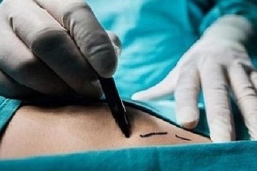 Môi giới bán thận để hưởng lợi, nam thanh niên bị xét xử 3 tội danh