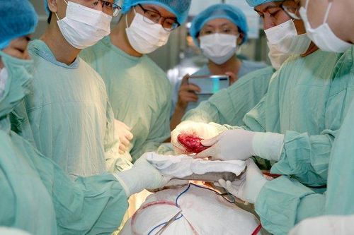 Ghép thận tự thân cho bệnh nhân U60
