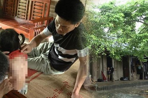 Bé 7 tuổi bị hàng xóm tạt cả ca nước sôi vào người: 'Sao nỡ lòng ra tay dã man như thế?'