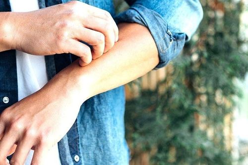 Campuchia phát hiện ca đậu mùa khỉ đầu tiên
