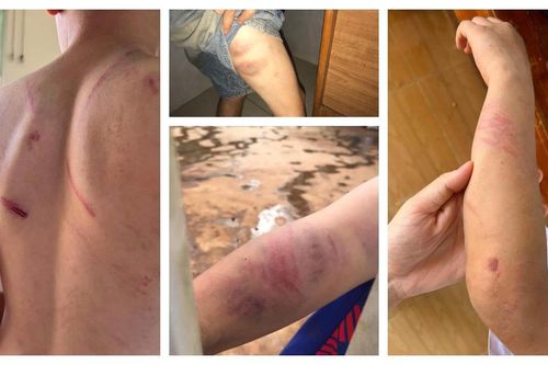 Thông tin mới nhất vụ bé trai 9 tuổi ở Đắk Lắk bị bạo hành