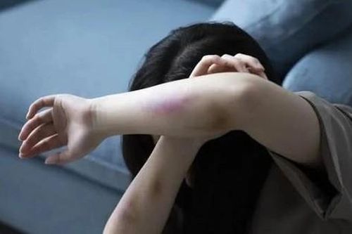 Bé gái 7 tuổi nghi bị bạo hành với nhiều vết thương trên người: Cơ quan chức năng vào cuộc