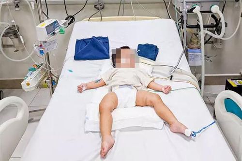 Hình ảnh vết lằn, bầm tím trên người bé 1 tuổi nghi bị bạo hành ở Hà Nội