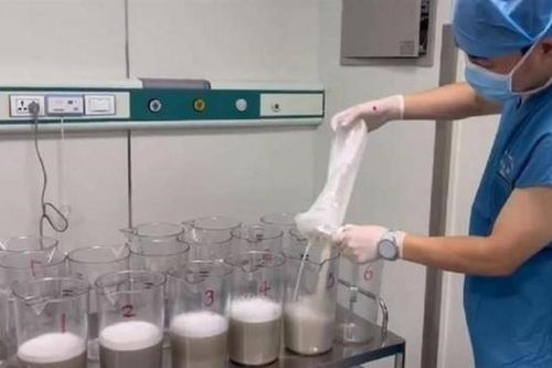 Hút 17 lít 'sữa' khỏi phổi bệnh nhân, bác sĩ sốc nặng