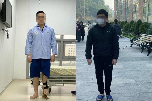 Kéo dài chân tới 18cm cho chàng trai 23 tuổi