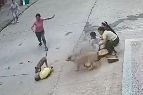 Bé 3 tuổi bị chó hoang tấn công, sống sót kì diệu nhờ được chó nhà cứu
