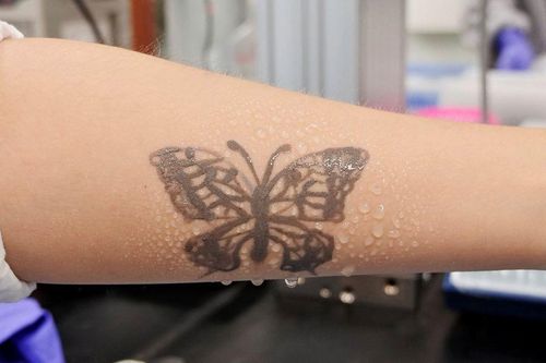 Hàn Quốc phát triển hình xăm công nghệ nano làm thiết bị theo dõi sức khỏe