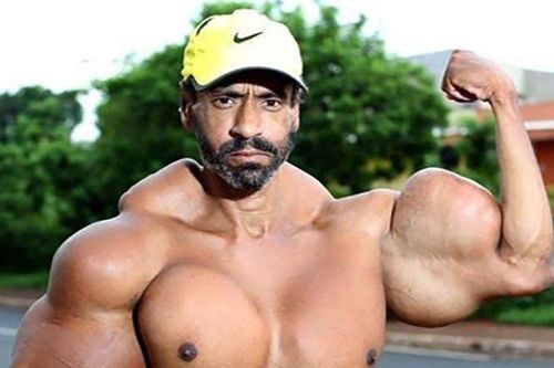 'Hulk Brazil' qua đời ở tuổi 55