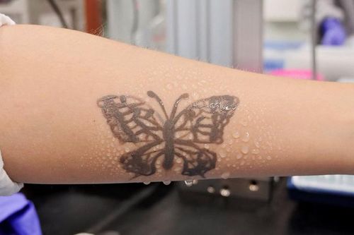 Hàn Quốc phát triển 'hình xăm' công nghệ nano giúp cảnh báo các vấn đề sức khỏe