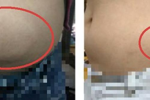 Truy tìm thủ phạm khiến vùng kín người đàn ông có 'vật thể lạ', sưng phồng, chạy lên bụng