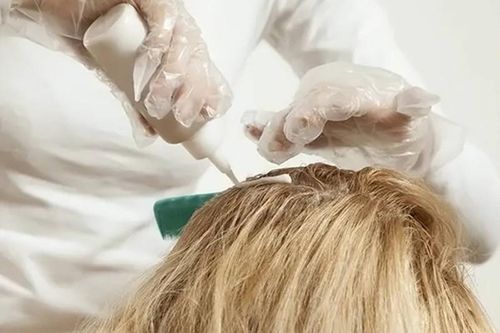 Mỗi tháng nhuộm tóc 2 lần, cô gái trẻ khiến gan tổn thương nặng