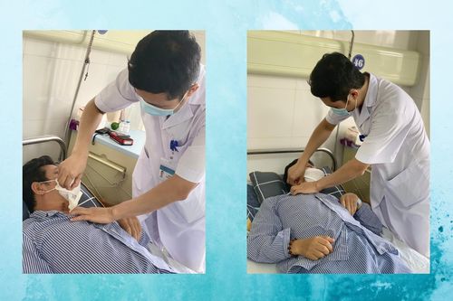Tưởng ung thư, ai ngờ mảnh gỗ nằm 4 tháng trong đốt sống cổ