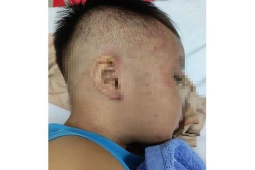 Cấp cứu kịp thời bé trai 4 tuổi bị bạo hành nhét vào tủ đông