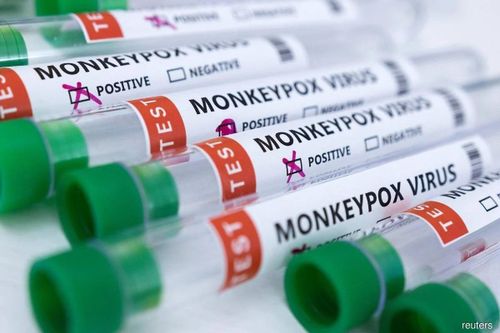 Phát hiện mới về nơi tồn tại của virus đậu mùa khỉ