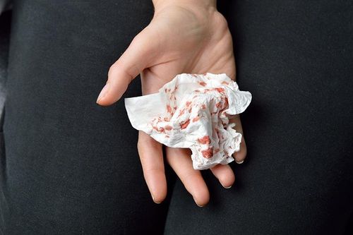 Dấu hiệu bạn đã mắc bệnh lao