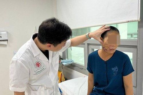 Người phụ nữ 55 tuổi 'nát' mặt do máy cắt cỏ