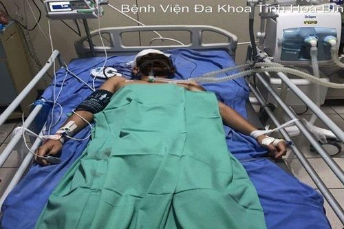 Sau 3 ngày đau đầu, nam sinh 16 tuổi phải nhập viện vì xuất huyết não